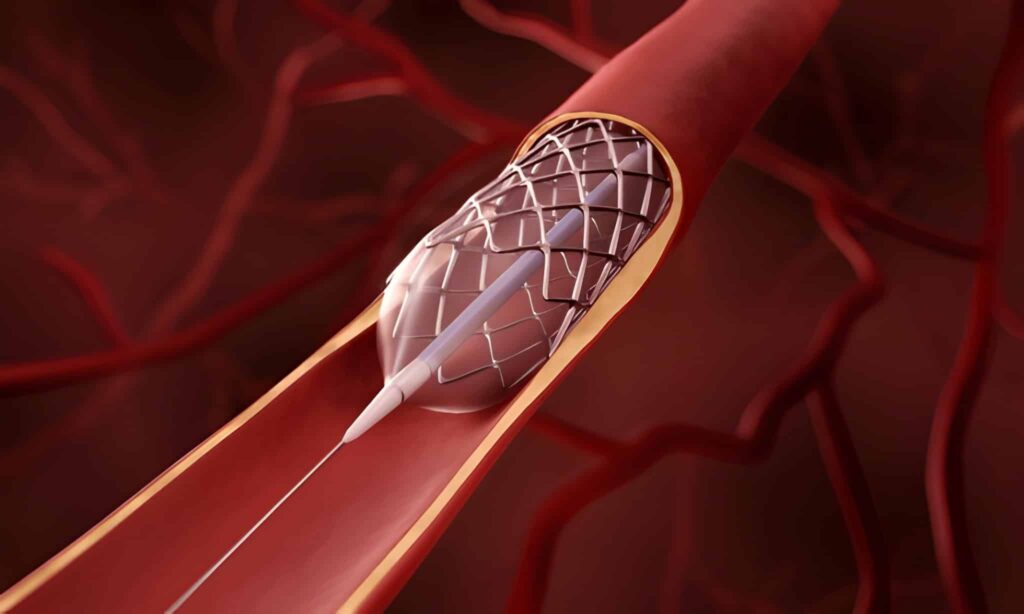 Interventional cardiology educational event