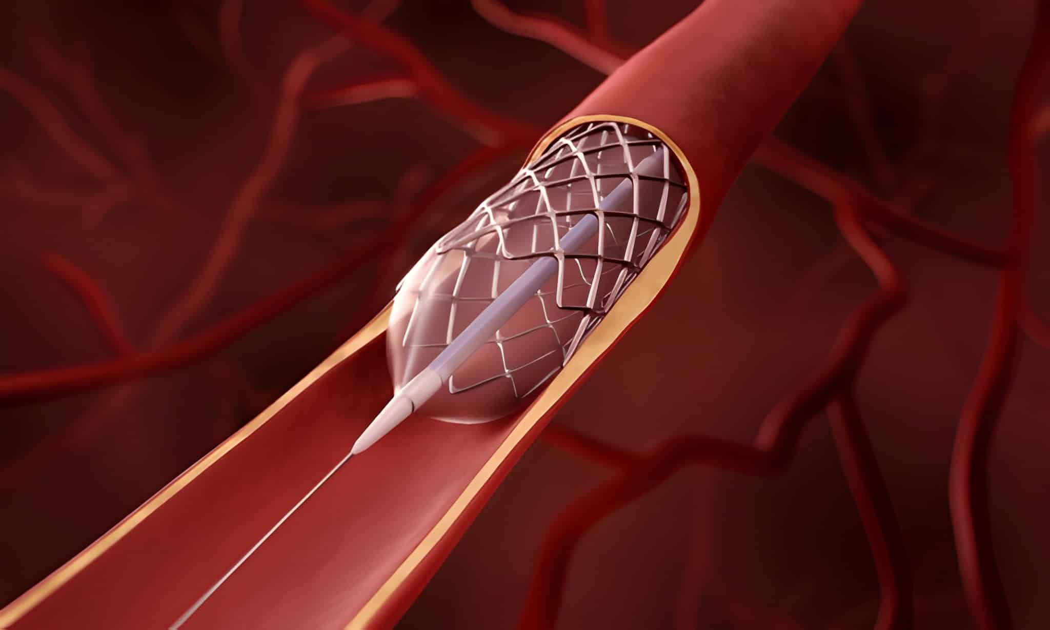 Interventional cardiology educational event